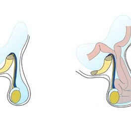 endometr