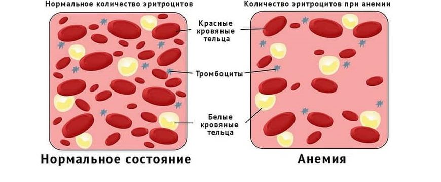 Магеря картина беременность без анемии