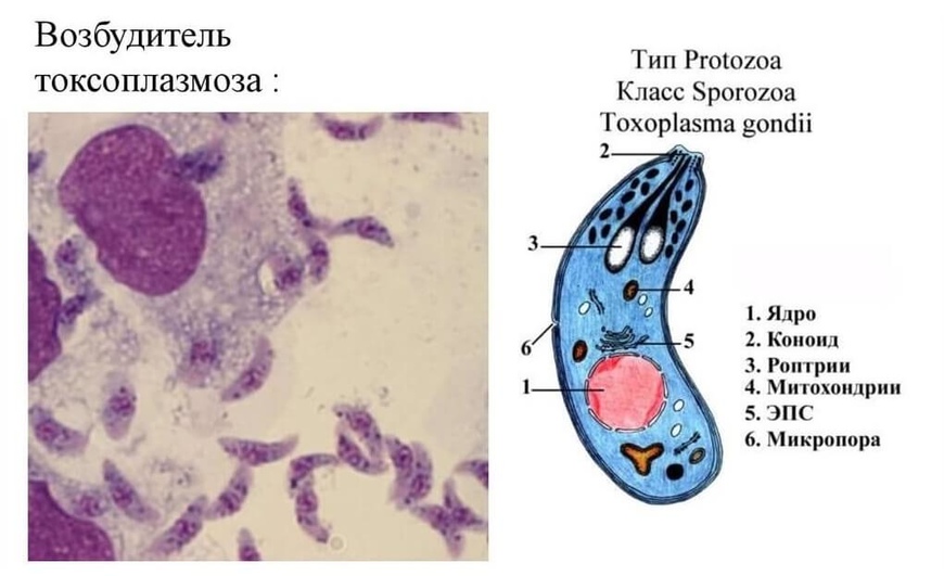 Лечение хронического токсоплазмоза у взрослых схема лечения